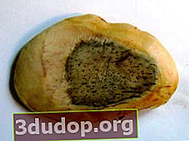 Coupe longitudinale d'une graine de mangue